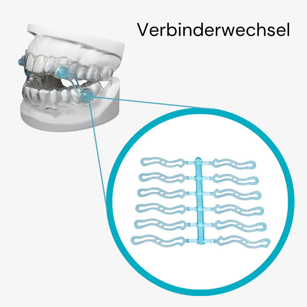 Anleitung: Verbinderwechsel bei der Schnarchschienen