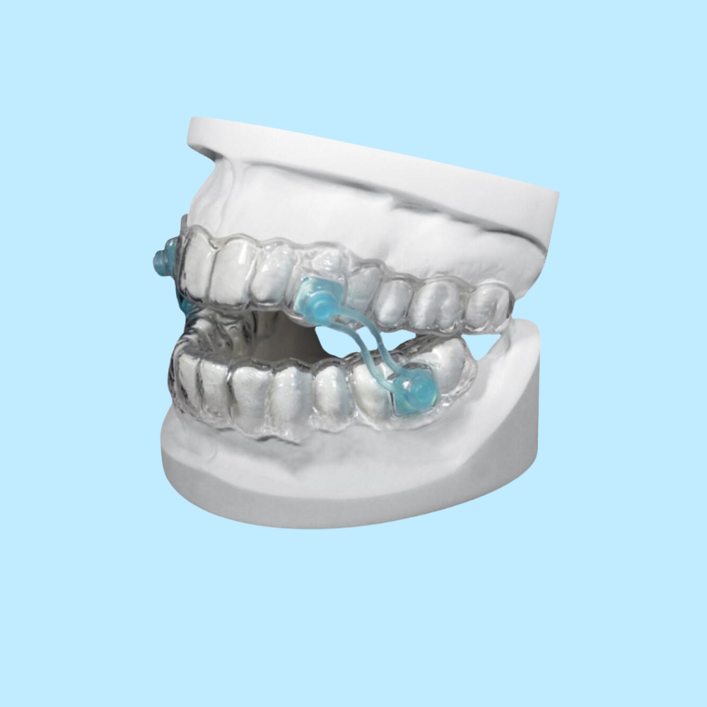 Silensor SL Schnarchschiene von Erkodent auf Gebissabdruck